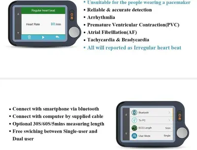 Wellue Pulsebit-EX ECG Monitor, Portable Heart Health Tracker photo 6