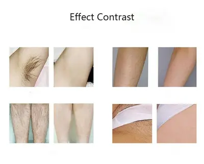 At-Home IPL Hair Removal Device, Portable photo 9