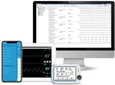 Checkme Pro 6-in-1 Health Monitor: ECG, Blood Oxygen and More photo 5