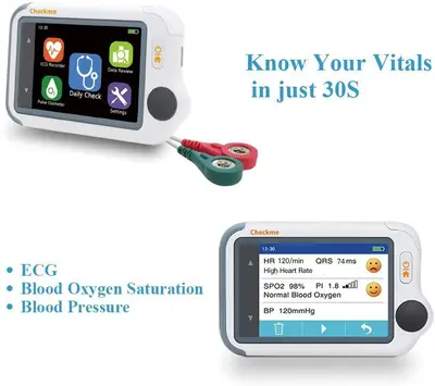 Wellue Checkme Lite Wireless Heart Monitor with SpO2 and EKG photo 7
