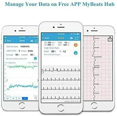 Wellue Checkme Lite Wireless Heart Monitor with SpO2 and EKG photo 8