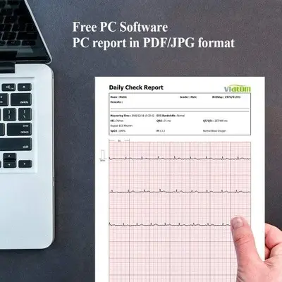Wellue Checkme Lite Wireless Heart Monitor with SpO2 and EKG photo 9