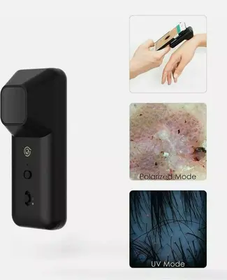 SKIARY Smartphone Dermatoscope Skin Analyzer Microscope photo 3