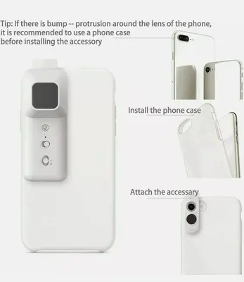 SKIARY Smartphone Dermatoscope Skin Analyzer Microscope photo 10