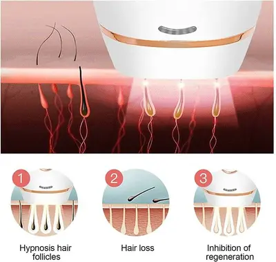 Whole Body IPL Pulsed Light Hair Removal Device, 5 Levels photo 4
